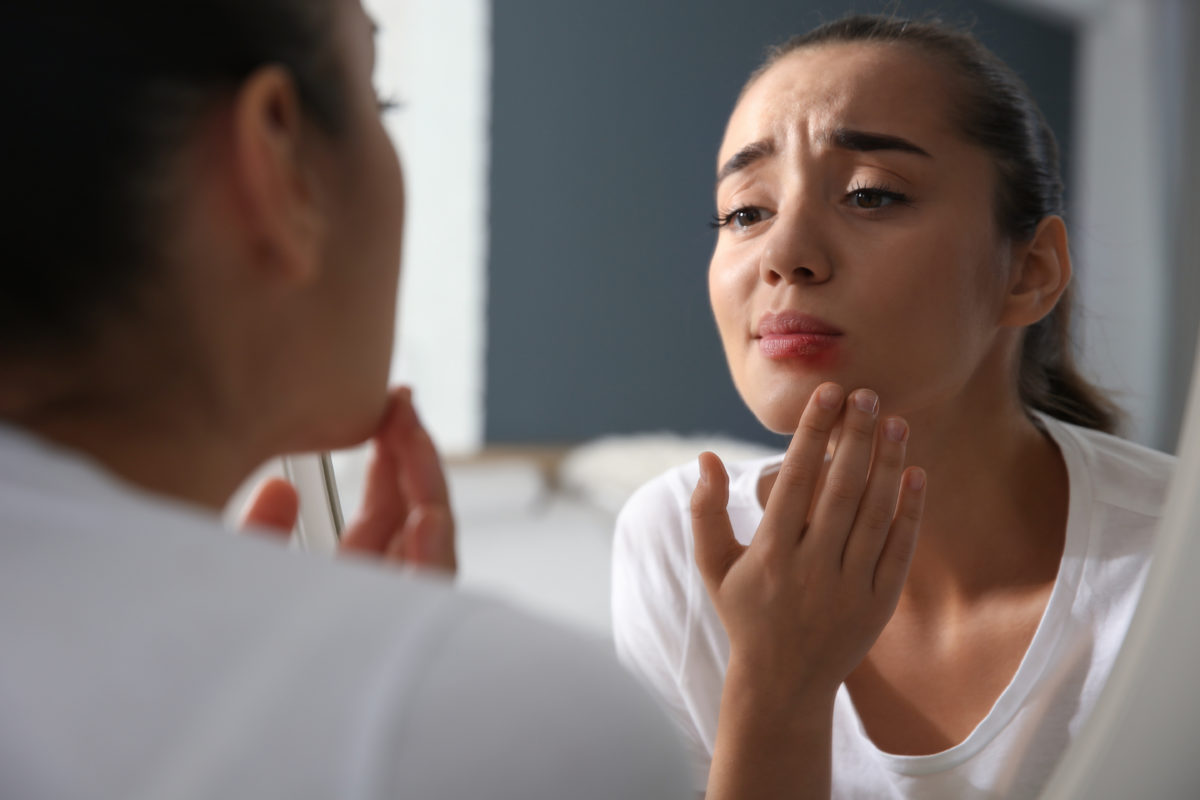 Bouton de fièvre, Herpès labial : toutes nos astuces naturelles pour s’en débarrasser