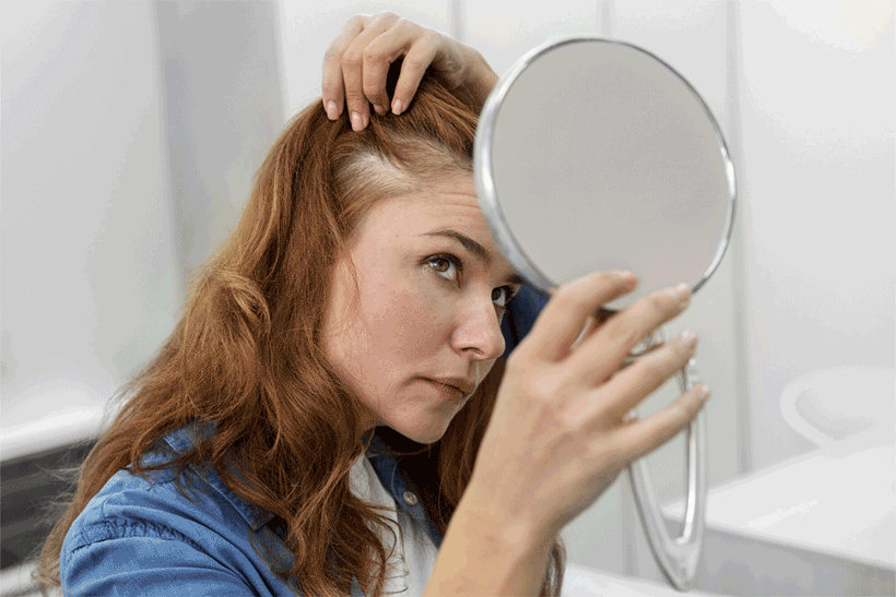 Perte de cheveux chez la femme : causes et solutions naturelles