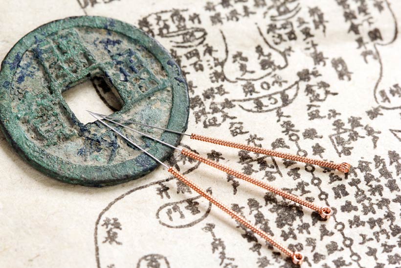 acupuncture-2
